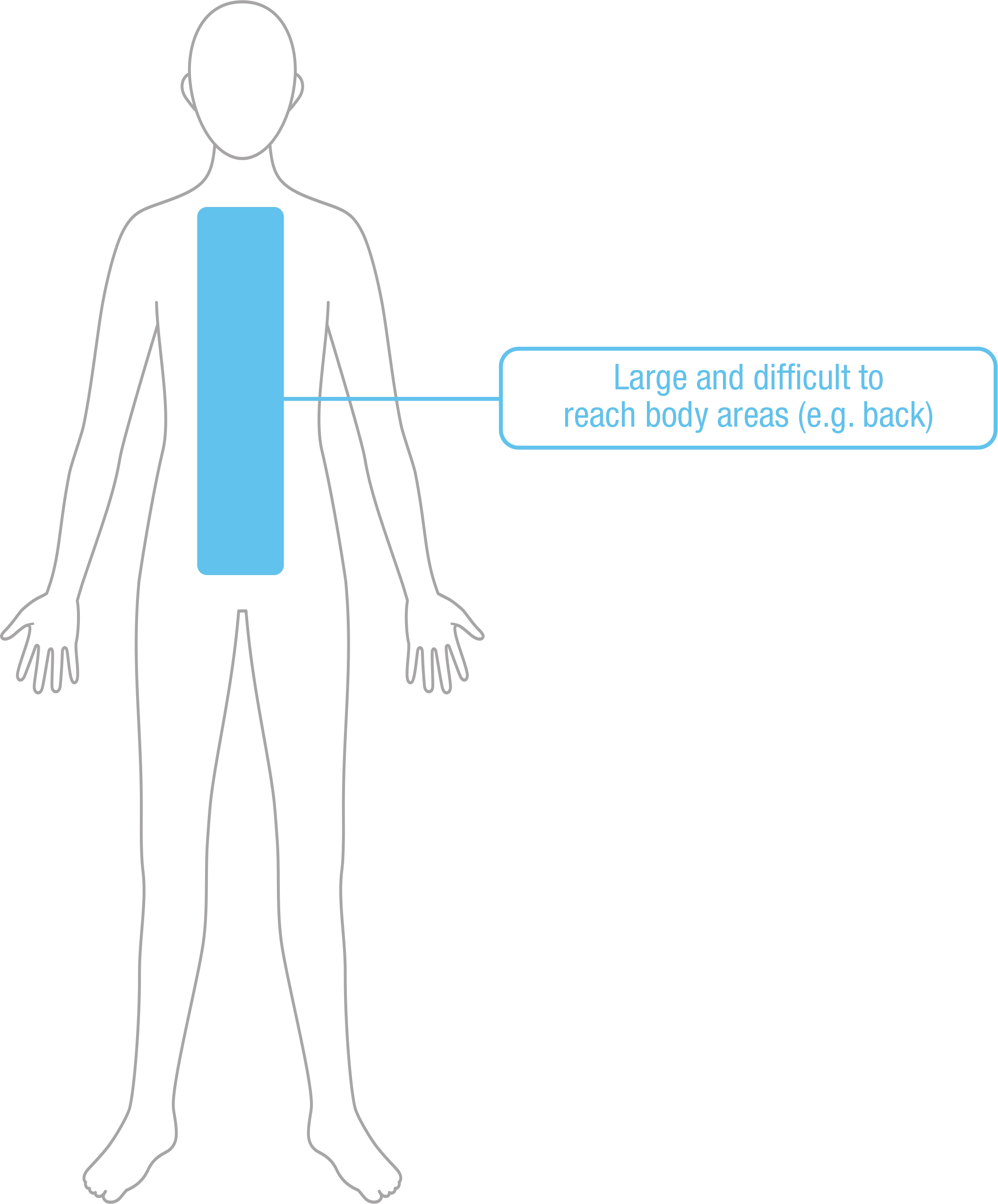 Dermaid 1 percent Spray Body